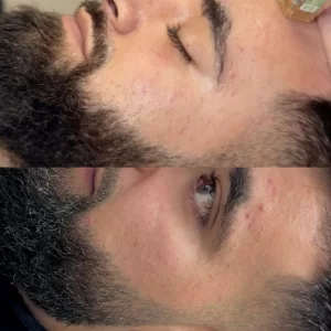 83A04DAF-4A49-43F3-A4E9-FA63F8AF9D86-300x300