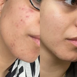 CD13F0A6-58D4-4F9E-8969-1ADF85E94FDD-300x300