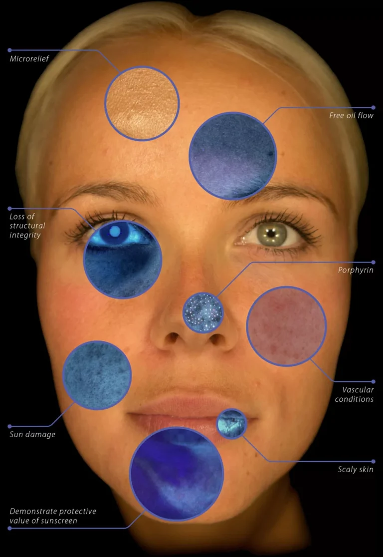 observ-skin-analysis-skin-concerns